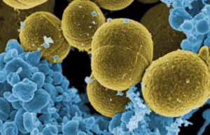 Bacteriën in de vijver en het vijverfilter